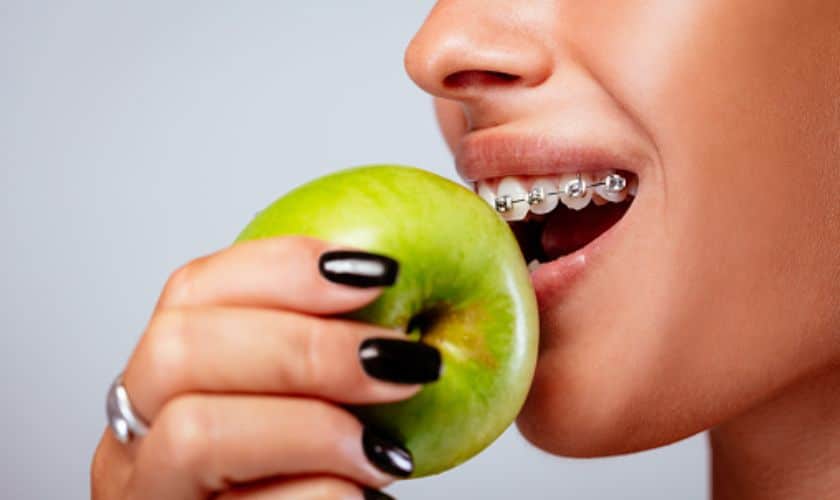 What foods to eat & avoid with Braces | Braces Southlake