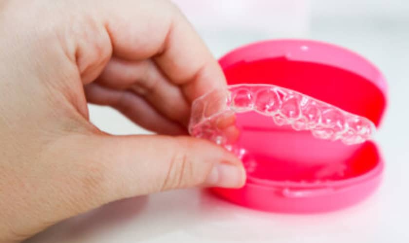 do's & don'ts while wearing invisalign