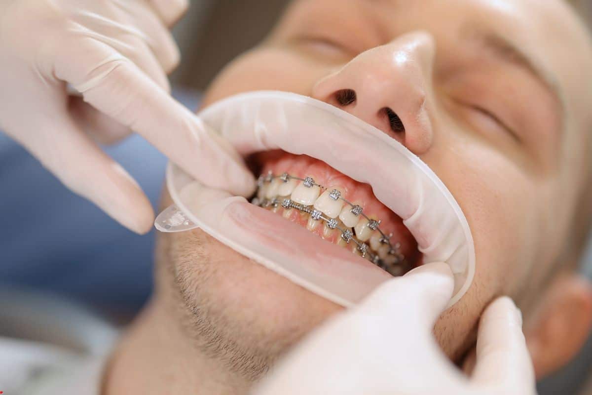 Orthodontic Treatment in Southlake