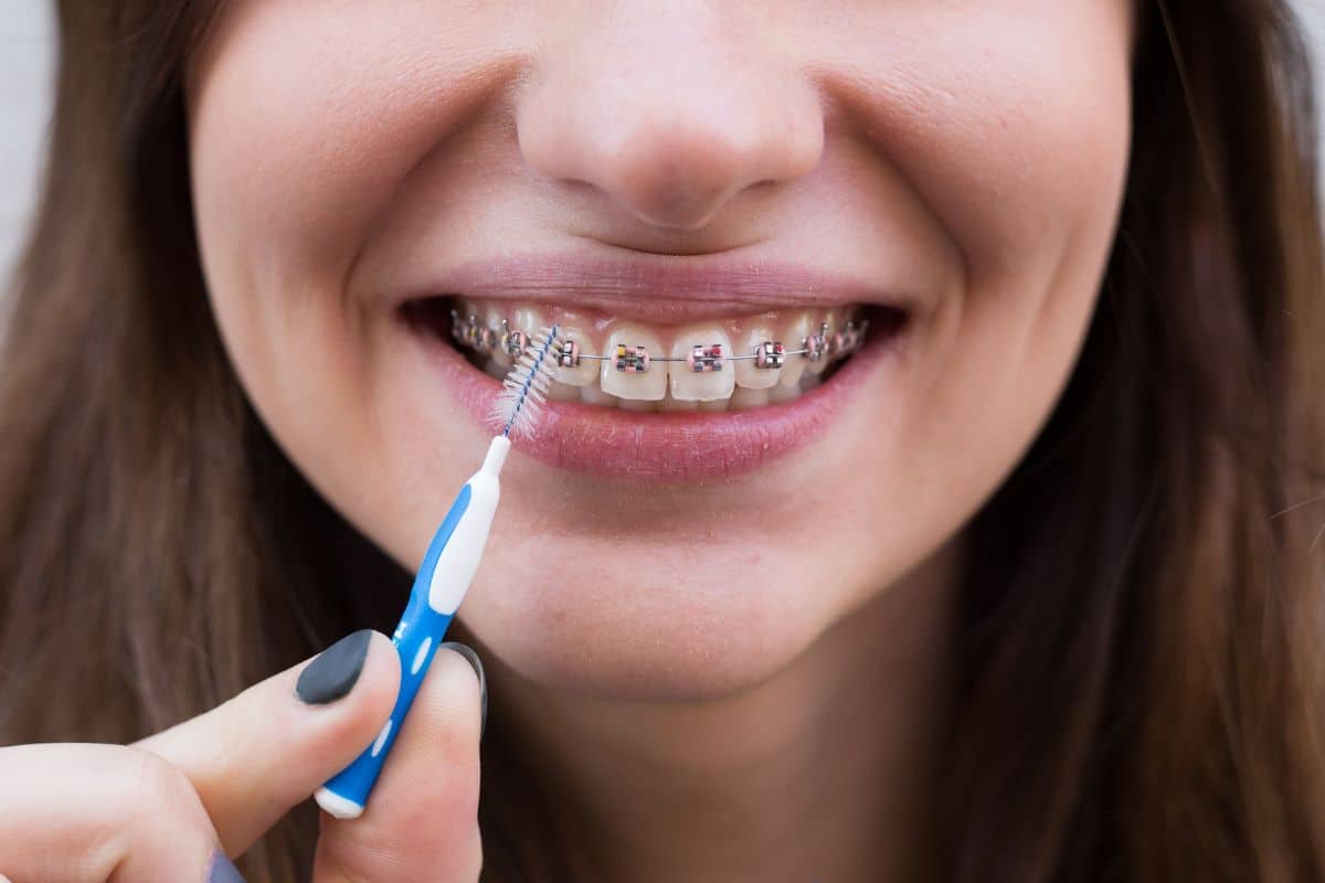 Dental Braces in Southlake