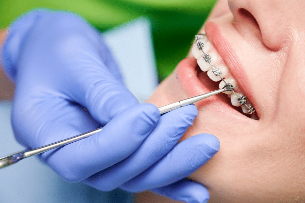 Get Results Faster with braces in southlake