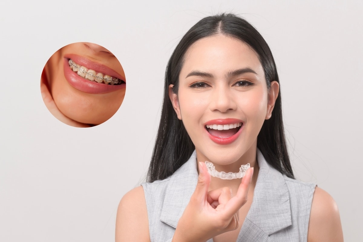 From Braces to Clear Aligners which orthodontic treatment in Southlake is better