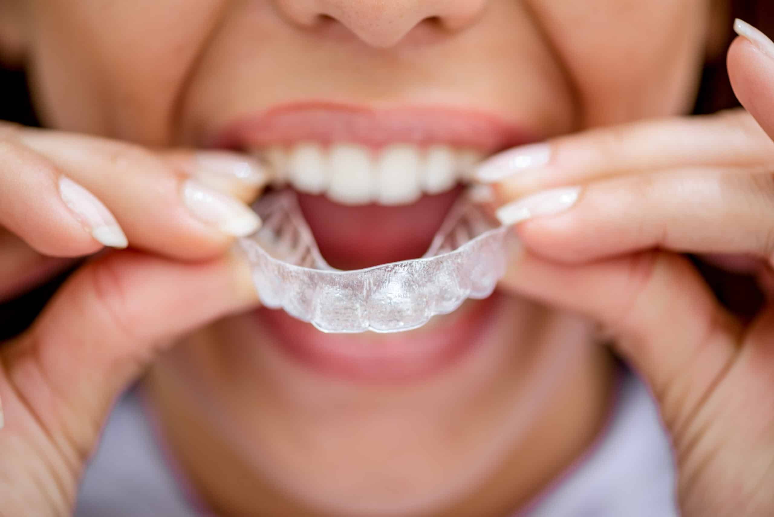 Invisalign Southlake
