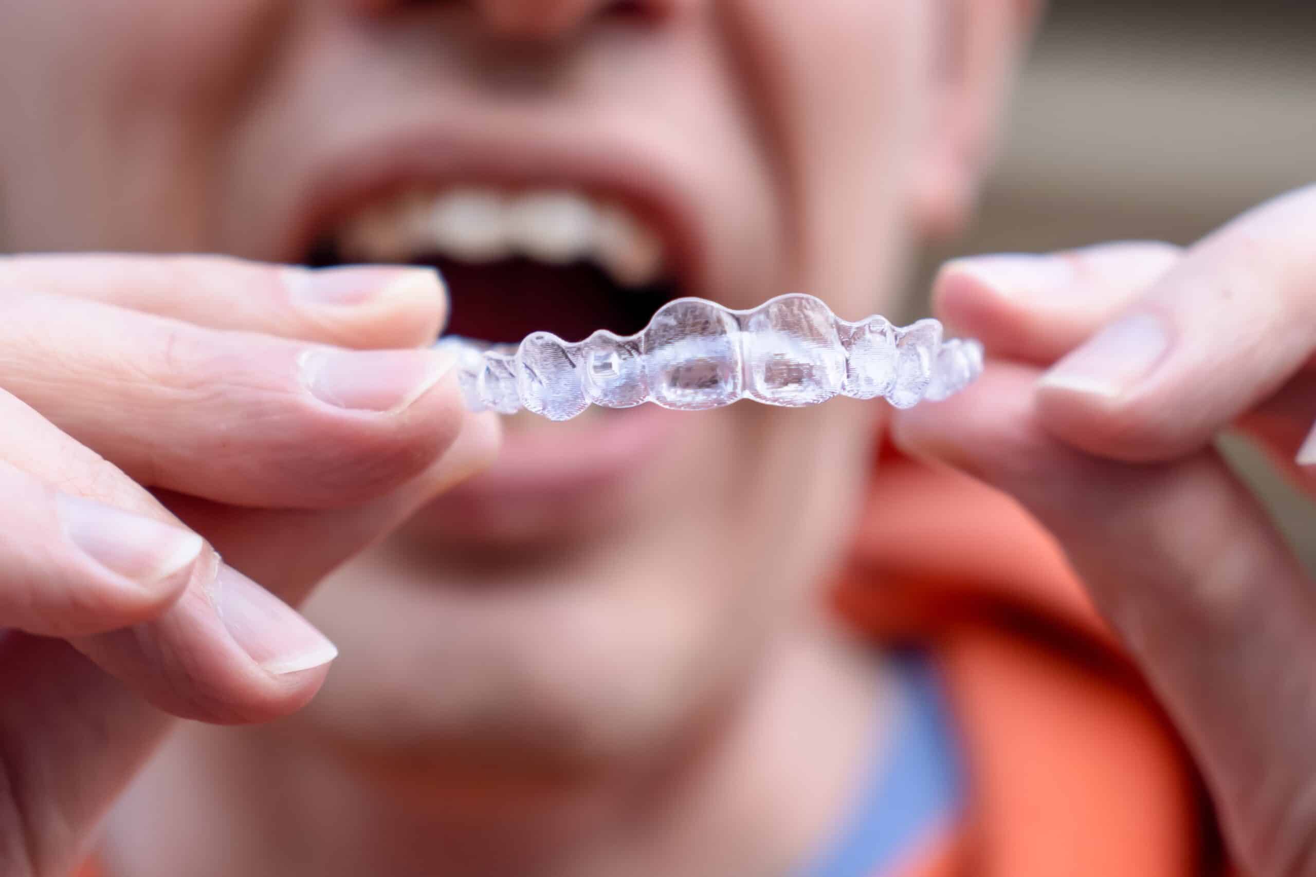 Invisalign