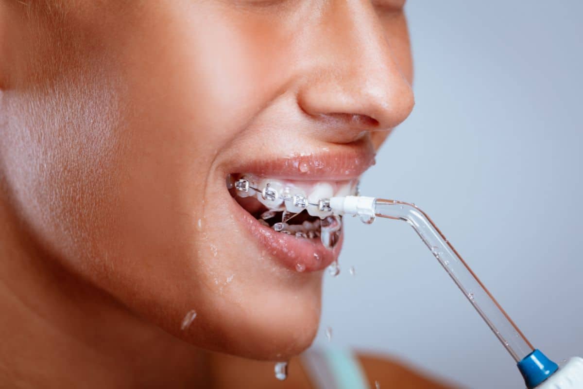 A close-up of a patient using a water flosser around braces, demonstrating effective flossing techniques to remove plaque and food particles during orthodontic treatment.
