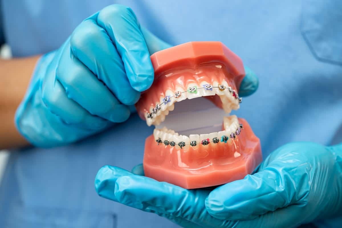 Braces in Southlake