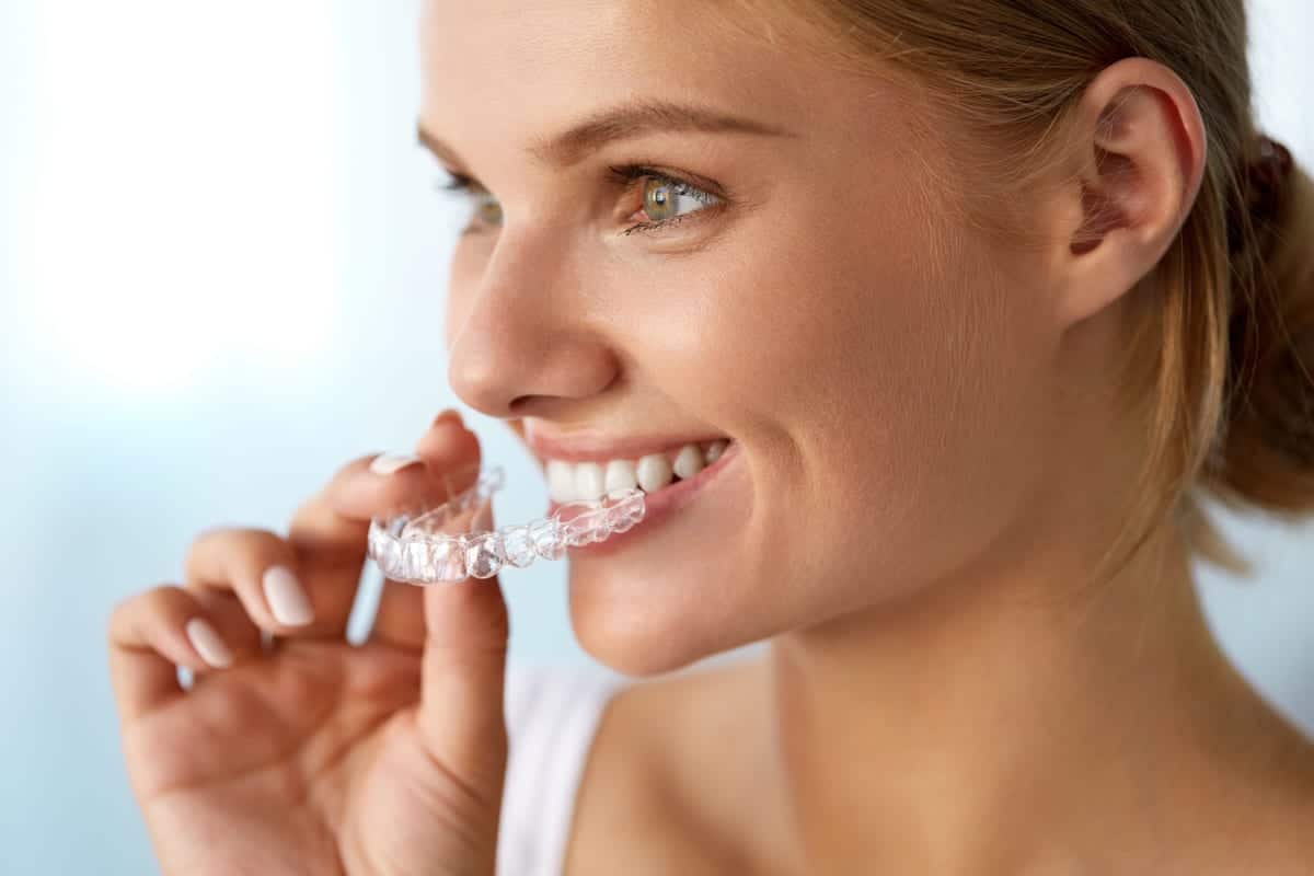 Clear Aligners in Southlake